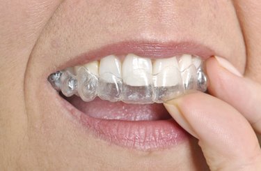 Invisalign Coverage: Understanding Your Dental Insurance Benefits