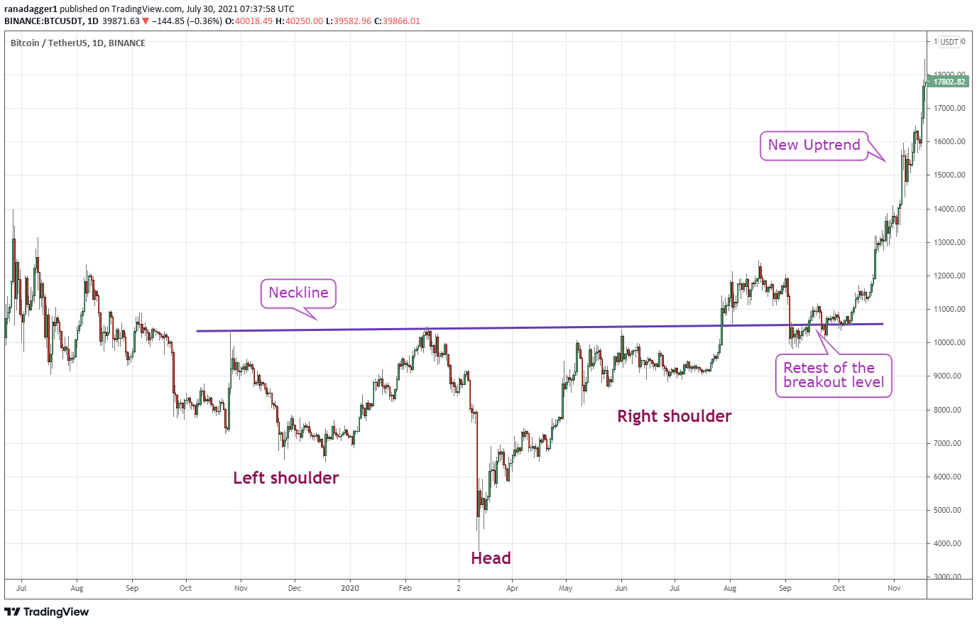 Pro traders look for this classic pattern to spot Bitcoin price reversals